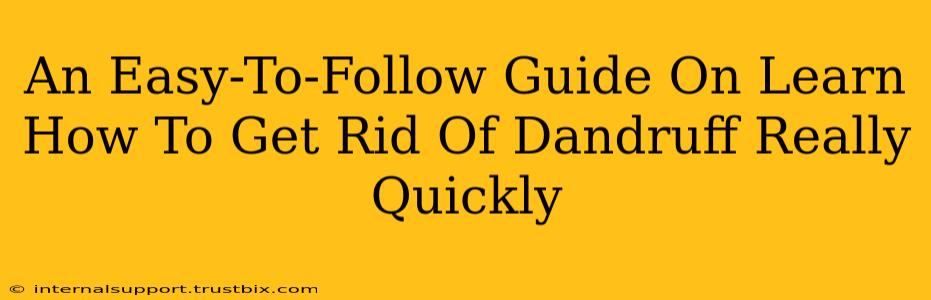 An Easy-To-Follow Guide On Learn How To Get Rid Of Dandruff Really Quickly