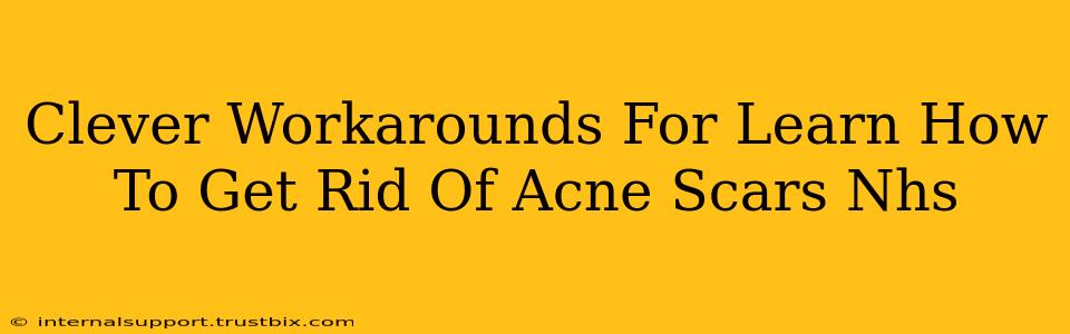 Clever Workarounds For Learn How To Get Rid Of Acne Scars Nhs