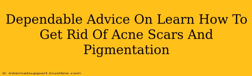 Dependable Advice On Learn How To Get Rid Of Acne Scars And Pigmentation