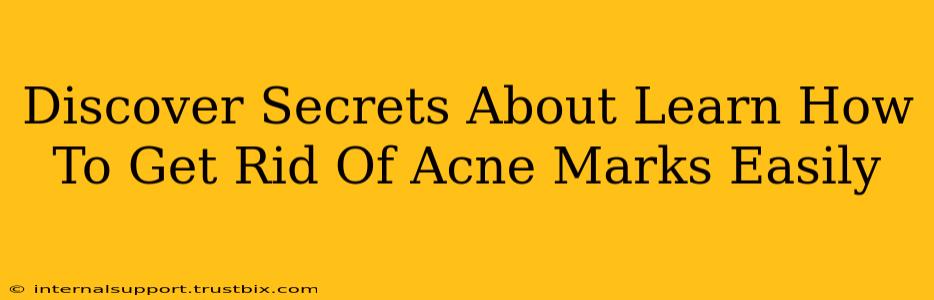 Discover Secrets About Learn How To Get Rid Of Acne Marks Easily