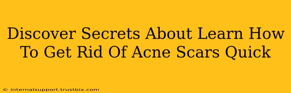 Discover Secrets About Learn How To Get Rid Of Acne Scars Quick