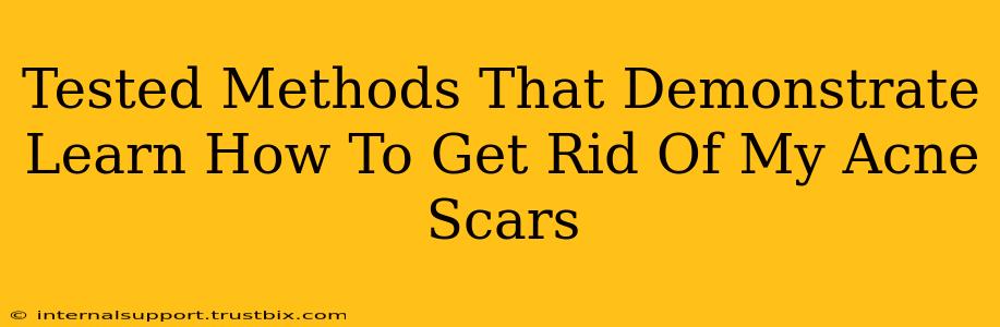 Tested Methods That Demonstrate Learn How To Get Rid Of My Acne Scars