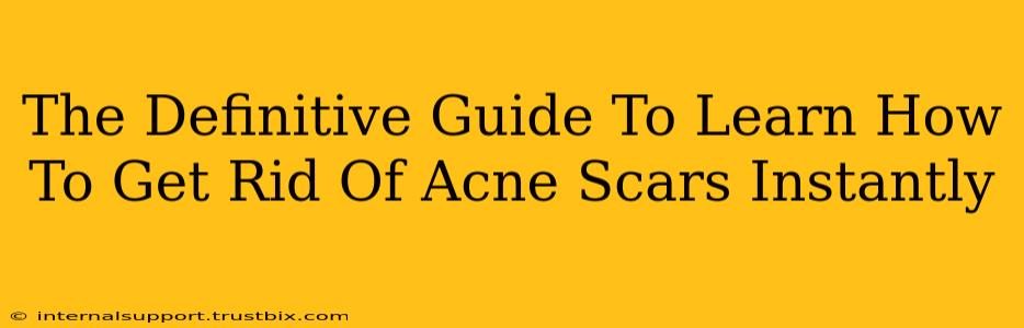 The Definitive Guide To Learn How To Get Rid Of Acne Scars Instantly