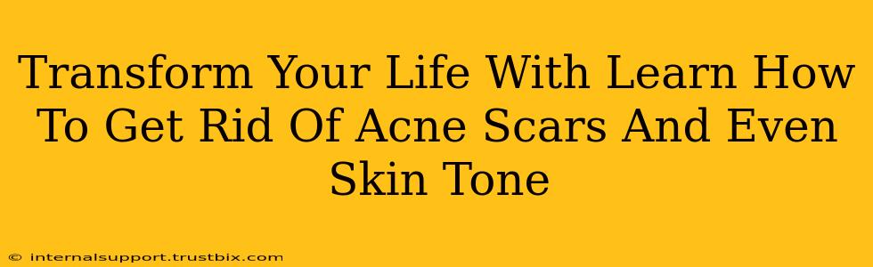 Transform Your Life With Learn How To Get Rid Of Acne Scars And Even Skin Tone