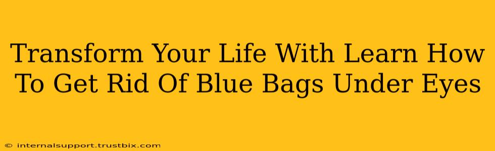 Transform Your Life With Learn How To Get Rid Of Blue Bags Under Eyes